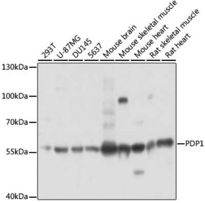 Western Blot: Pyruvate Dehydrogenase Phosphatase/PDP1/PPM2C AntibodyAzide and BSA Free [NBP2-93618]