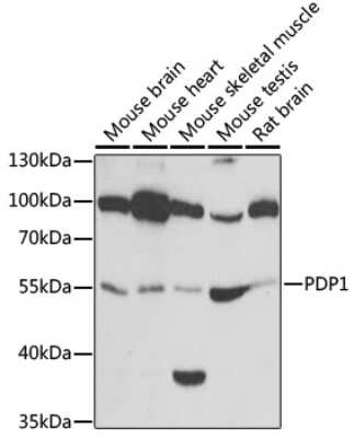 Western Blot: Pyruvate Dehydrogenase Phosphatase/PDP1/PPM2C AntibodyBSA Free [NBP2-93866]