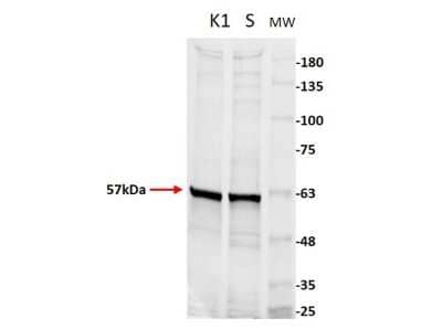 Western Blot: Pyruvate Kinase Antibody [NBP2-44231]