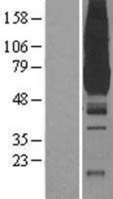 Western Blot: PKLR Overexpression Lysate [NBL1-14460]