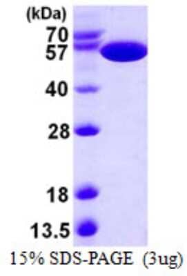 SDS-PAGE: Recombinant E. coli PKLR His Protein [NBP2-22656]