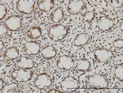 Immunohistochemistry-Paraffin: QARS Antibody (5F5) [H00005859-M01]