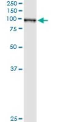 Immunoprecipitation: QARS Antibody (5F5) [H00005859-M01]