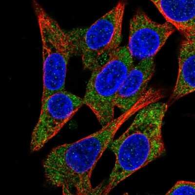 Immunocytochemistry/ Immunofluorescence: QARS Antibody [NBP2-37883]