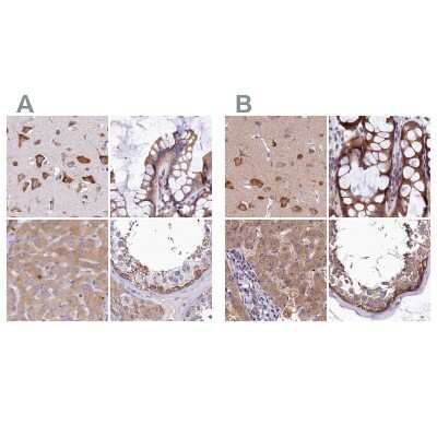 Immunohistochemistry-Paraffin: QARS Antibody [NBP1-89487]