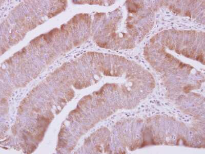 Immunohistochemistry-Paraffin: QARS Antibody [NBP2-20028]