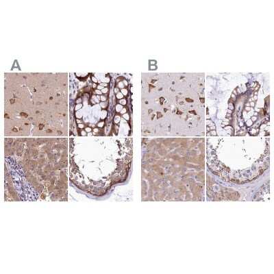 Immunohistochemistry-Paraffin: QARS Antibody [NBP2-37883]