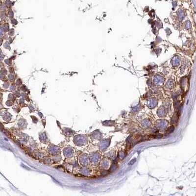 Immunohistochemistry-Paraffin: QARS Antibody [NBP2-37883]