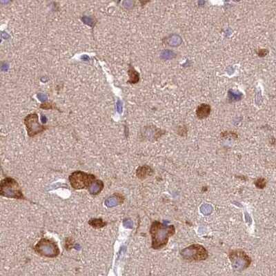 Immunohistochemistry-Paraffin: QARS Antibody [NBP2-37883]