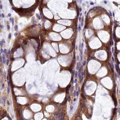 Immunohistochemistry-Paraffin: QARS Antibody [NBP2-37883]