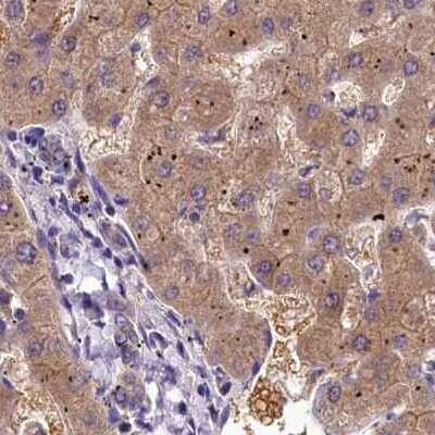 Immunohistochemistry-Paraffin: QARS Antibody [NBP2-37883]