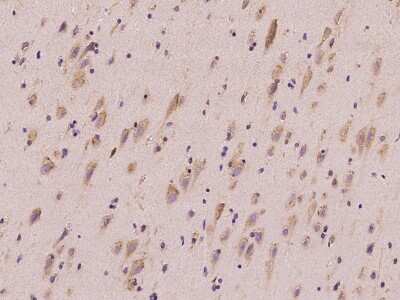 Immunohistochemistry-Paraffin: QARS Antibody [NBP2-98572]