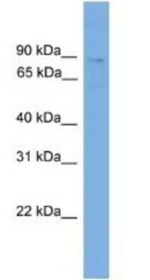 Western Blot: QARS Antibody [NBP1-79632]