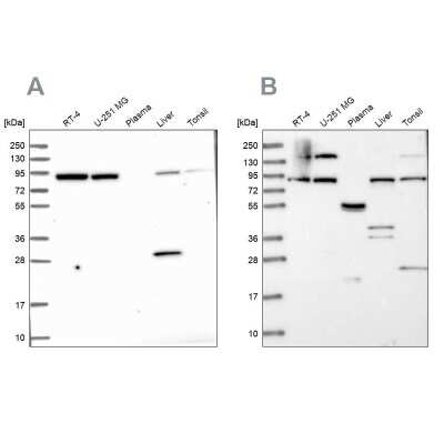 Western Blot: QARS Antibody [NBP1-89487]