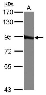 Western Blot: QARS Antibody [NBP2-20028]