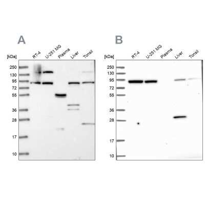 Western Blot: QARS Antibody [NBP2-37883]