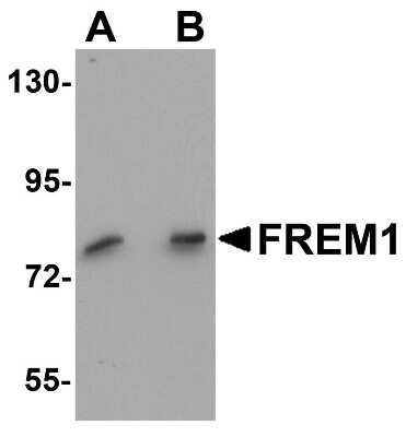 Western Blot: QBRICK/FREM1 AntibodyBSA Free [NBP1-77180]