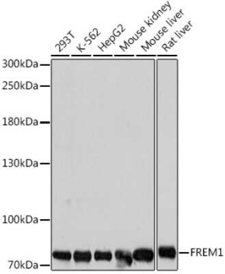 Western Blot: QBRICK/FREM1 AntibodyAzide and BSA Free [NBP2-94701]