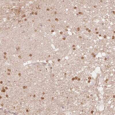 Immunohistochemistry-Paraffin: QDPR Antibody [NBP2-49455]