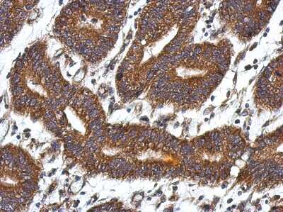 Immunohistochemistry-Paraffin: QDPR Antibody [NBP2-15084]