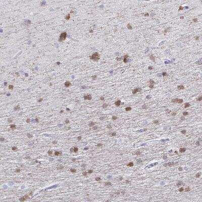 Immunohistochemistry-Paraffin: QDPR Antibody [NBP2-32408]