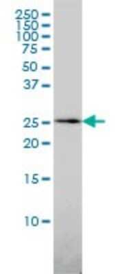 Western Blot: QDPR Antibody (M1) [H00005860-M02]