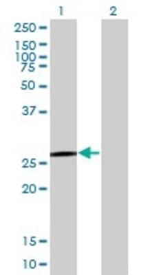 Western Blot: QDPR Antibody (M1) [H00005860-M02]