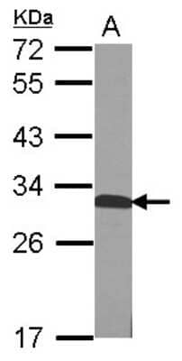 Western Blot: QDPR Antibody [NBP2-15084]
