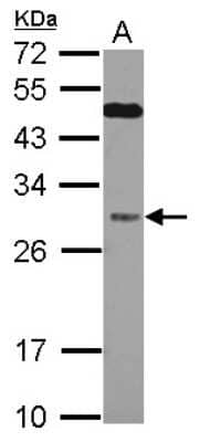 Western Blot: QDPR Antibody [NBP2-15084]