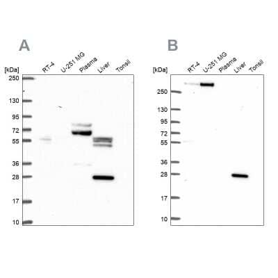 Western Blot: QDPR Antibody [NBP2-32408]