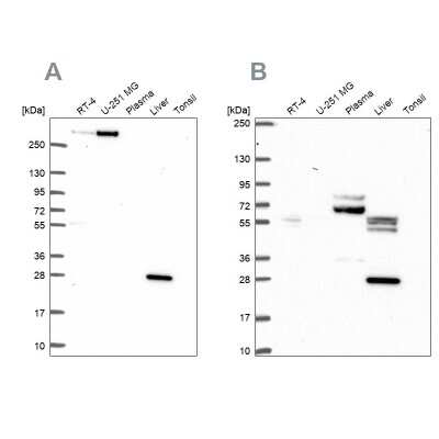 Western Blot: QDPR Antibody [NBP2-49455]