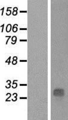 Western Blot: QDPR Overexpression Lysate [NBP2-09038]