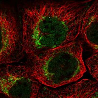 Immunocytochemistry/ Immunofluorescence: QIL1 Antibody [NBP1-80966]