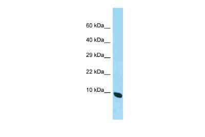 Western Blot: QIL1 Antibody [NBP3-09318]