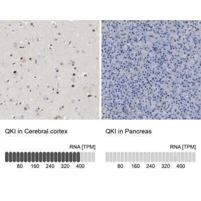Immunohistochemistry-Paraffin: QKI/Quaking Antibody [NBP1-87178]