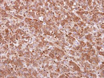 Immunohistochemistry-Paraffin: QKI/Quaking Antibody [NBP2-20029]