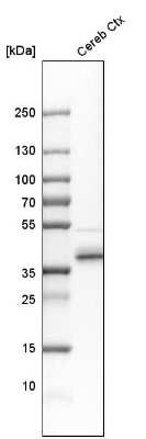 Western Blot: QKI/Quaking Antibody [NBP1-87178]