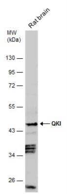 Western Blot: QKI/Quaking Antibody [NBP2-20029]