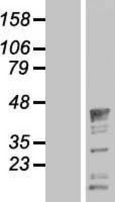 Western Blot: QKI/Quaking Overexpression Lysate [NBL1-15026]