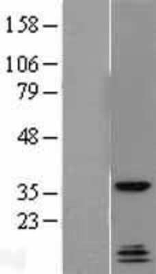 Western Blot: QKI/Quaking Overexpression Lysate [NBL1-15027]