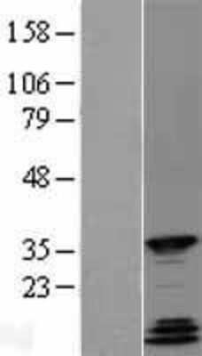 Western Blot: QKI/Quaking Overexpression Lysate [NBL1-15028]