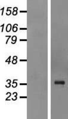 Western Blot: QKI/Quaking Overexpression Lysate [NBP2-04457]