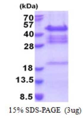 SDS-PAGE: Recombinant Human QKI/Quaking His Protein [NBP2-23390]