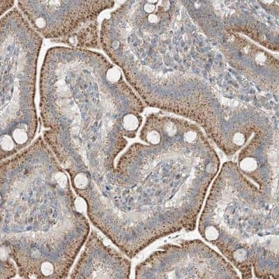 Immunohistochemistry: QN1 Antibody [NBP1-91157]