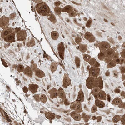 Immunohistochemistry-Paraffin: QN1 Antibody [NBP1-91156]