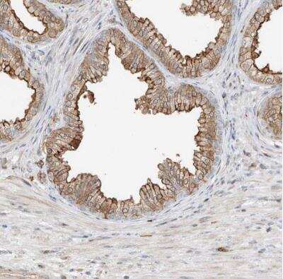 Immunohistochemistry-Paraffin: QN1 Antibody [NBP1-91158]