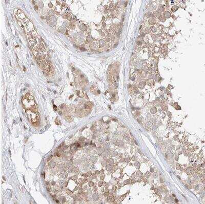 Immunohistochemistry-Paraffin: QN1 Antibody [NBP1-91158]