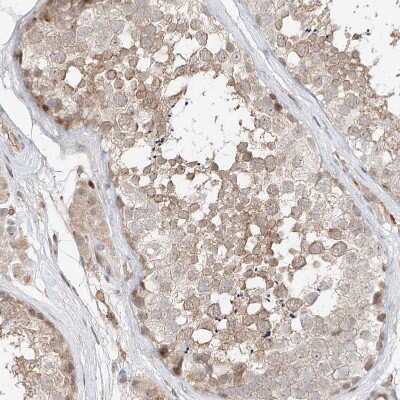 Immunohistochemistry-Paraffin: QN1 Antibody [NBP1-91158]
