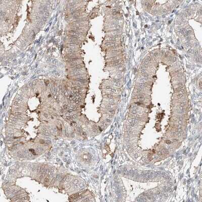 Immunohistochemistry-Paraffin: QN1 Antibody [NBP1-91158]