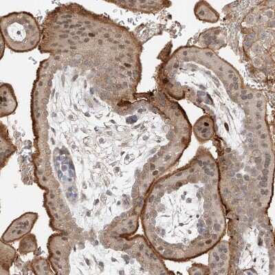 Immunohistochemistry-Paraffin: QN1 Antibody [NBP1-91158]
